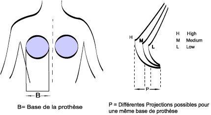 prothese mammaire marseille